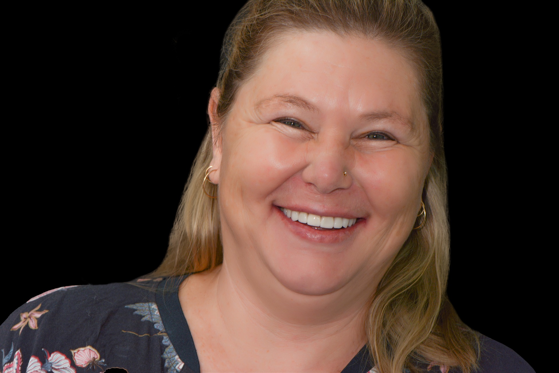 Patient Smiling with Bright Teeth