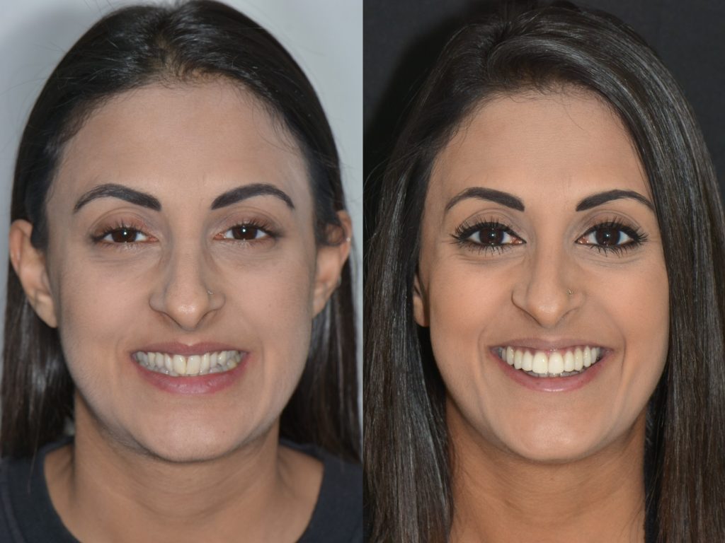 Smile makeover and cosmetic dentistry at Lorn Family and Cosmetic Dentistry in Maitland