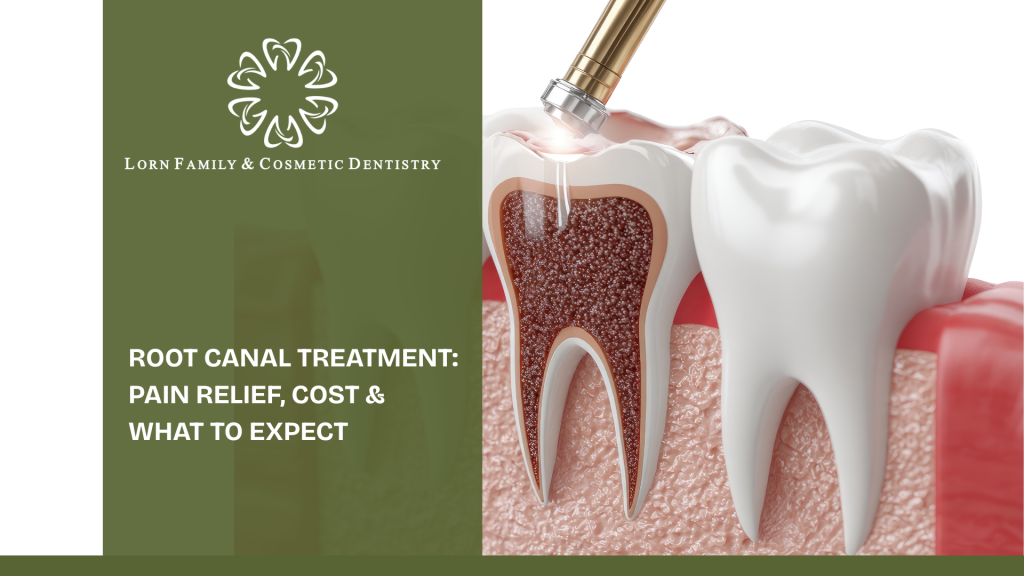 Root Canal Treatment: Pain Relief, Cost & What to Expect