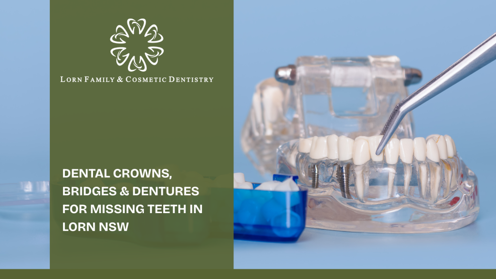 Dental Crowns, Bridges & Dentures for Missing Teeth in Lorn NSW
